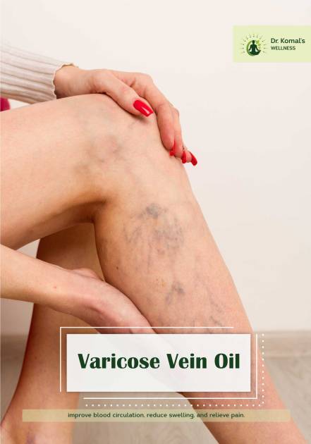 Varicose Vein Oil | Ayurvedic Relief for Vein Health & Circulation by Dr. Komal